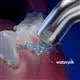Waterpik Classic Pik Pocket Tip (fits Classic water flossers only) – (PP-70E)