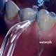 Waterpik Precision Tip –  (JT-100E)