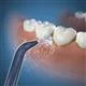 Waterpik Handheld Cordless Precision Low-Flow Tip  –  (JT-360E)