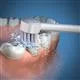 Waterpik Water Flosser Toothbrush Tip –  (TB-100E)