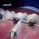 Waterpik Whitening Water Flosser - Orthodontic Tip –  (WOD-2E)